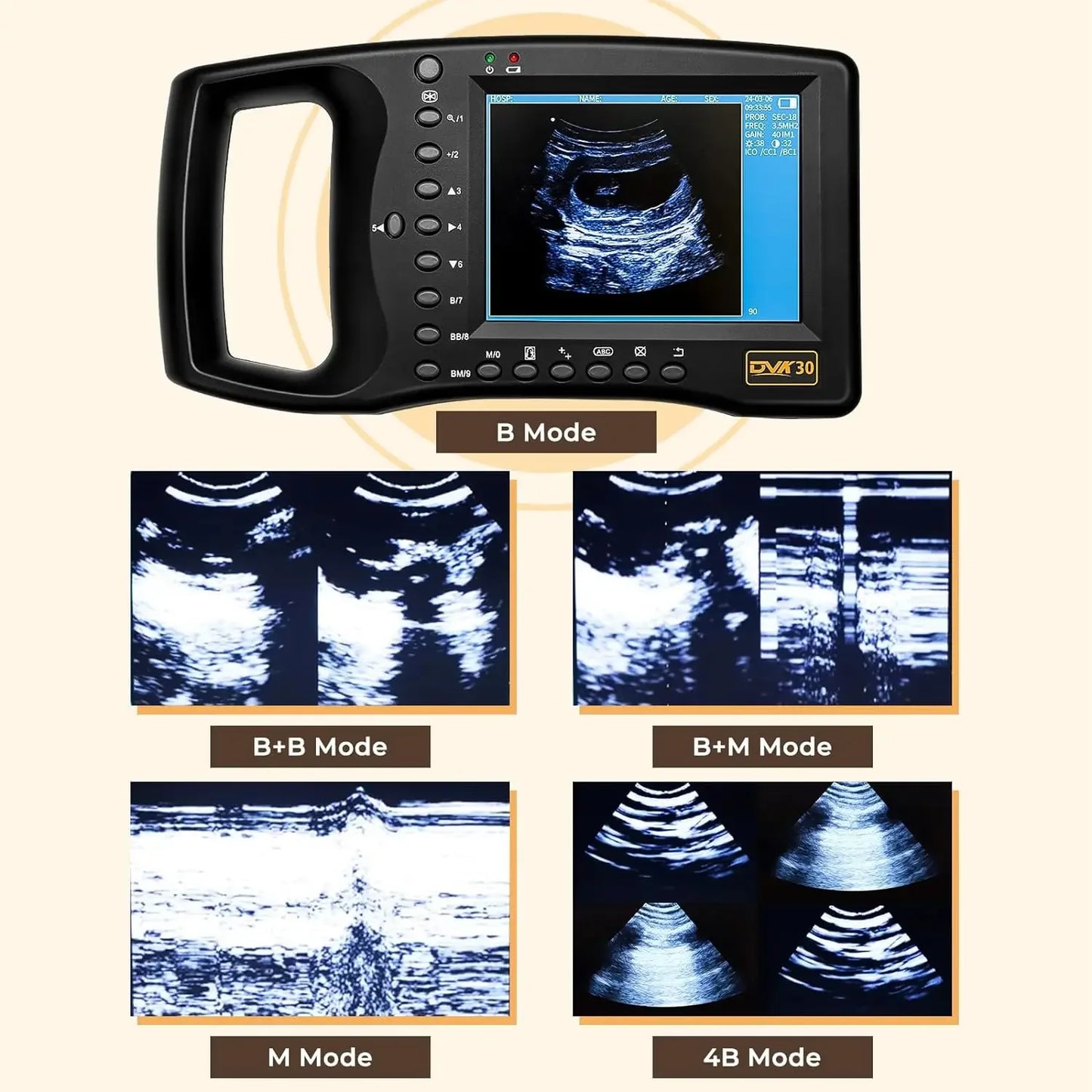 Portable Veterinary Ultrasound Scanner for Pregnancy Dog Sheep Pigs Vet Handheld Scanner with 3.5Mhz Mechanical Probe